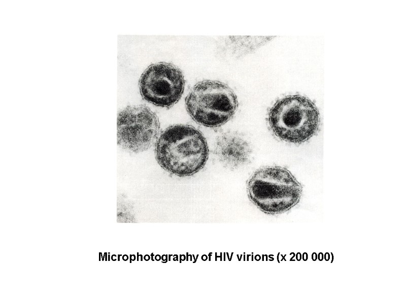 Microphotography of HIV virions (х 200 000)